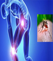 Chikungunya And Homeopathic Treatment